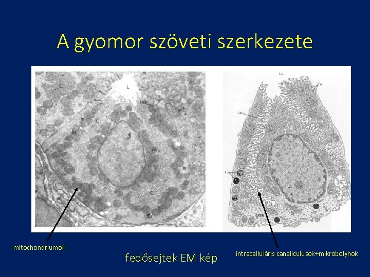 A gyomor szöveti szerkezete mitochondriumok fedősejtek EM kép intracelluláris canaliculusok+mikrobolyhok 