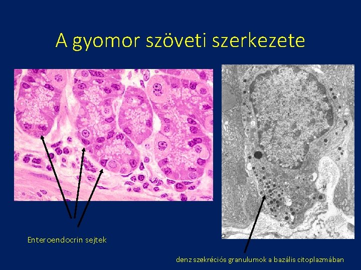 A gyomor szöveti szerkezete Enteroendocrin sejtek denz szekréciós granulumok a bazális citoplazmában 