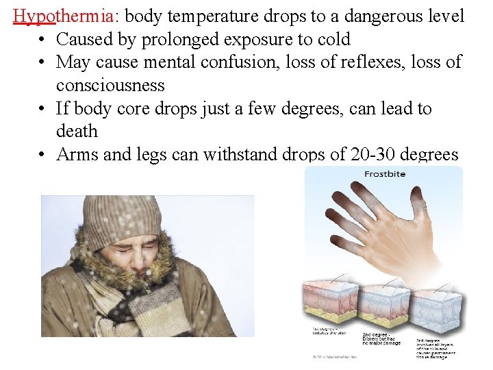 Hypothermia: body temperature drops to a dangerous level • Caused by prolonged exposure to