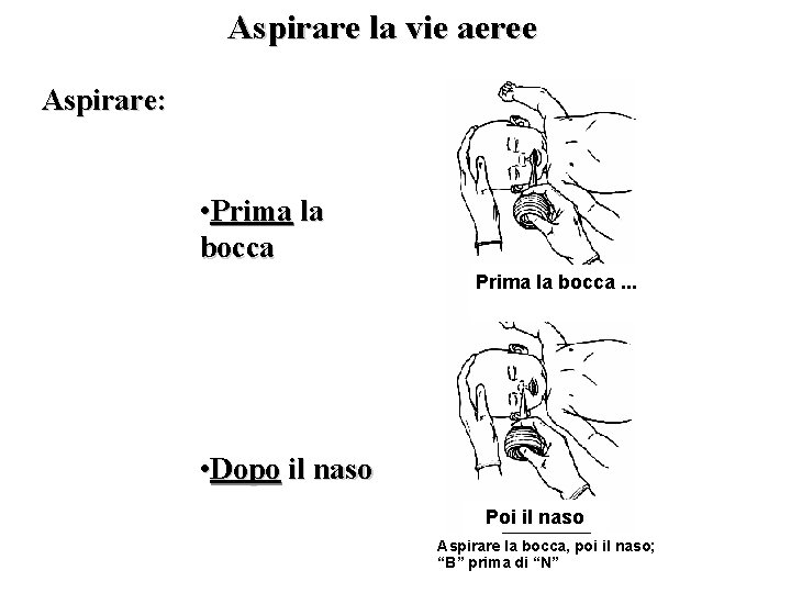  Aspirare la vie aeree Aspirare: • Prima la bocca. . . • Dopo