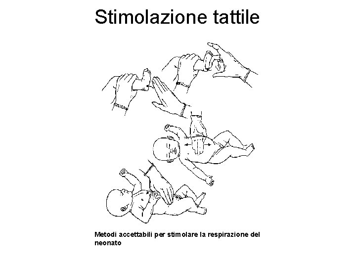 Stimolazione tattile Metodi accettabili per stimolare la respirazione del neonato 