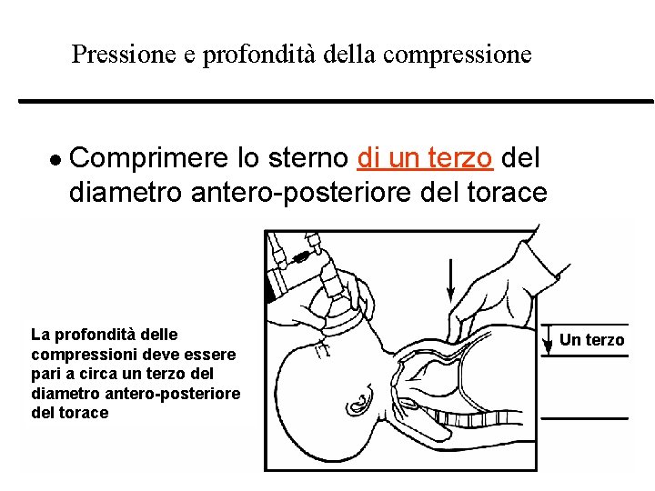 Pressione e profondità della compressione l Comprimere lo sterno di un terzo del diametro