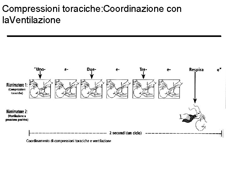 Compressioni toraciche: Coordinazione con la. Ventilazione Compressioni toraciche: Coordinazione con la. Ventilazione