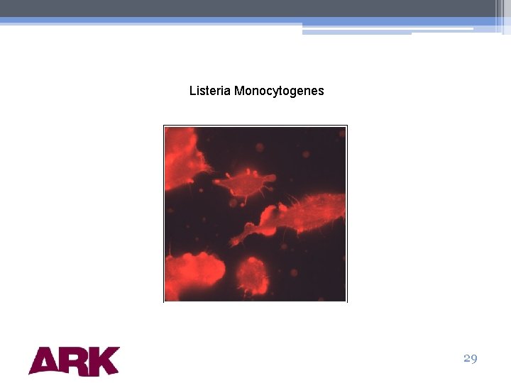Listeria Monocytogenes 29 