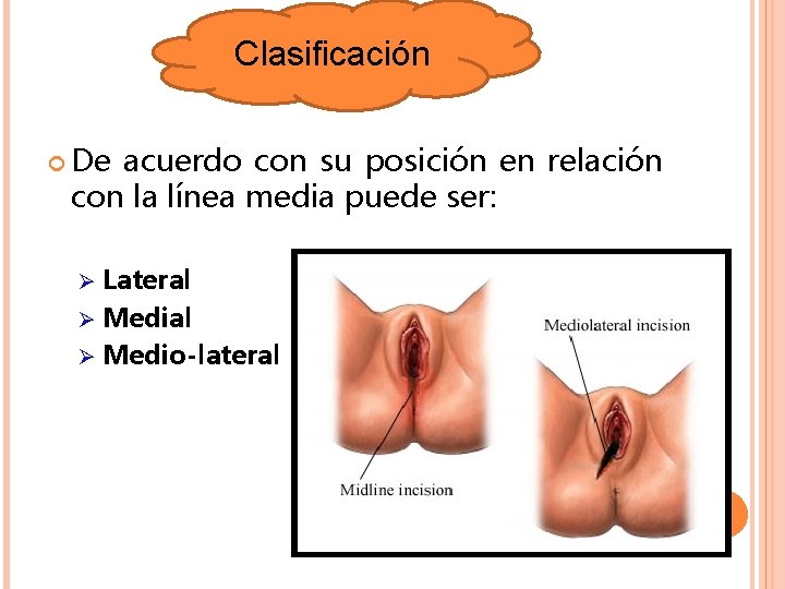Clasificación De acuerdo con su posición en relación con la línea media puede ser: Clasificación De acuerdo con su posición en relación con la línea media puede ser: