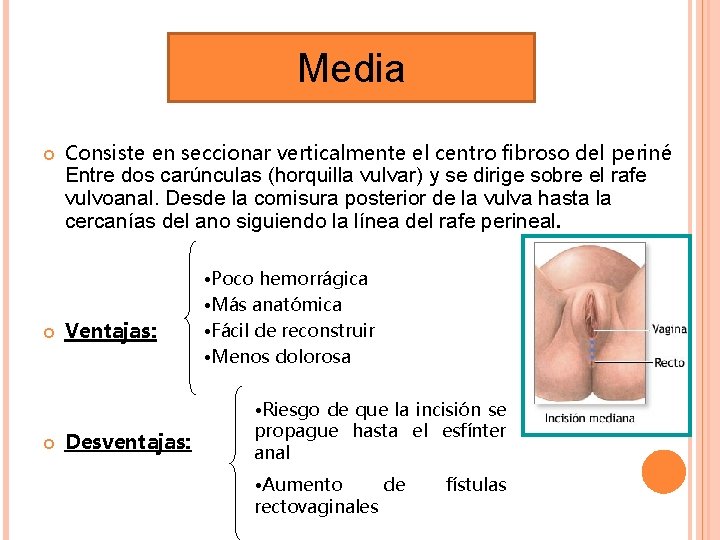 Media Consiste en seccionar verticalmente el centro fibroso del periné Entre dos carúnculas (horquilla Media Consiste en seccionar verticalmente el centro fibroso del periné Entre dos carúnculas (horquilla