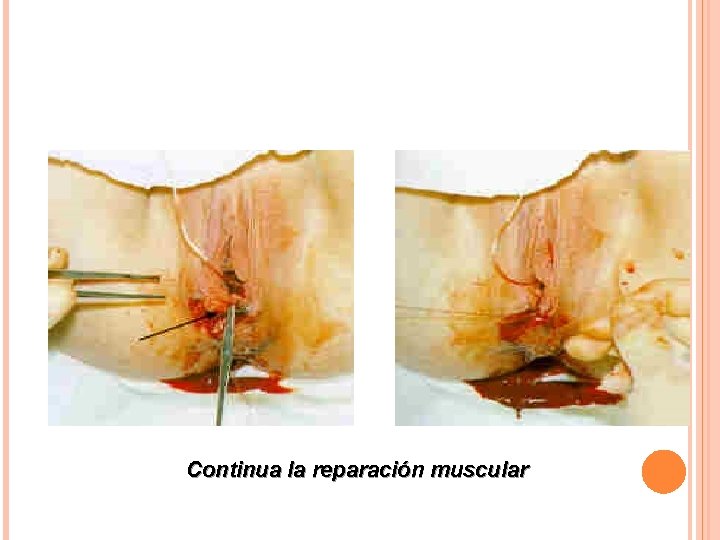Continua la reparación muscular Continua la reparación muscular