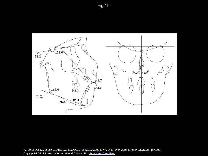 Fig 10 American Journal of Orthodontics and Dentofacial Orthopedics 2015 147 S 109 -S