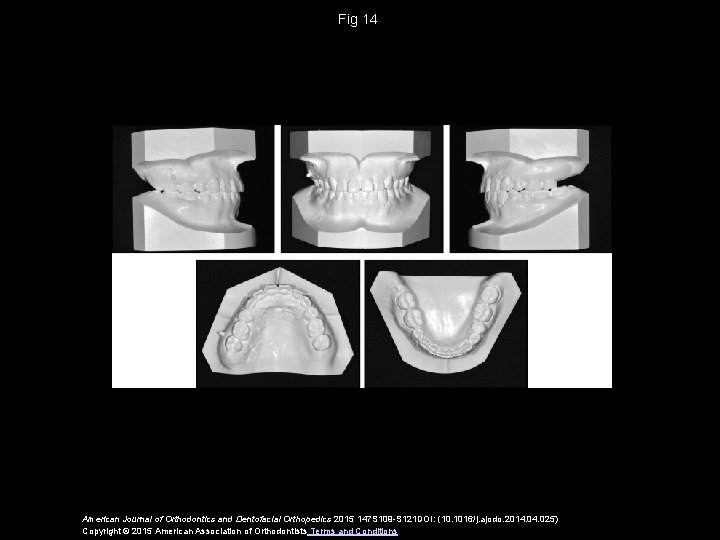 Fig 14 American Journal of Orthodontics and Dentofacial Orthopedics 2015 147 S 109 -S