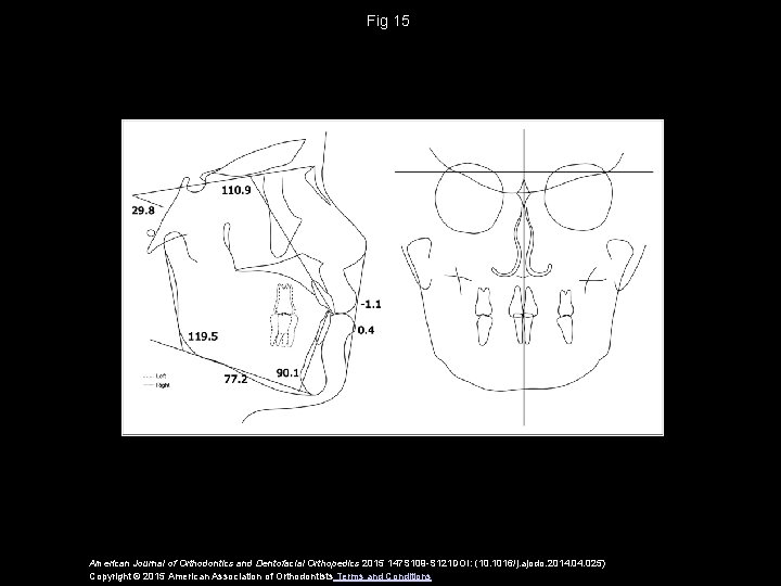 Fig 15 American Journal of Orthodontics and Dentofacial Orthopedics 2015 147 S 109 -S