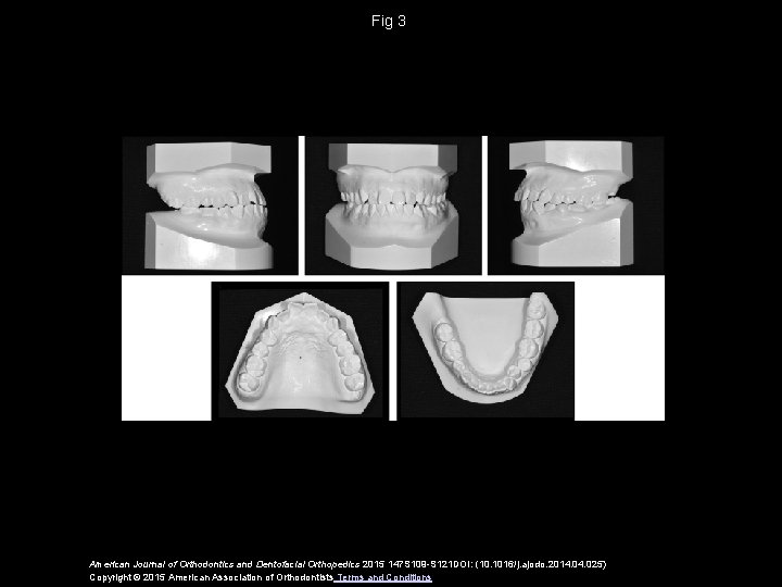 Fig 3 American Journal of Orthodontics and Dentofacial Orthopedics 2015 147 S 109 -S