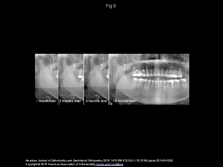 Fig 8 American Journal of Orthodontics and Dentofacial Orthopedics 2015 147 S 109 -S