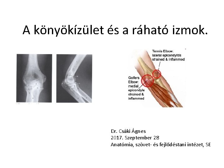 A könyökízület és a ráható izmok. Dr. Csáki Ágnes 2017. Szeptember 28 Anatómia, szövet- A könyökízület és a ráható izmok. Dr. Csáki Ágnes 2017. Szeptember 28 Anatómia, szövet-