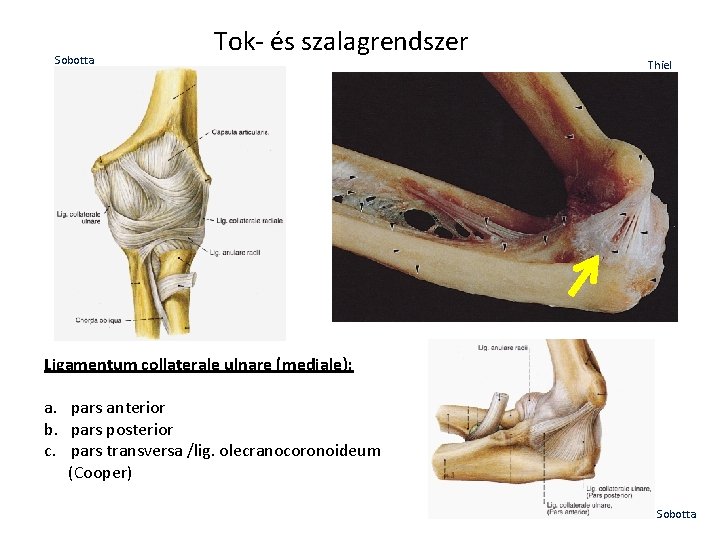 Sobotta Tok- és szalagrendszer Thiel Ligamentum collaterale ulnare (mediale): a. pars anterior b. pars Sobotta Tok- és szalagrendszer Thiel Ligamentum collaterale ulnare (mediale): a. pars anterior b. pars