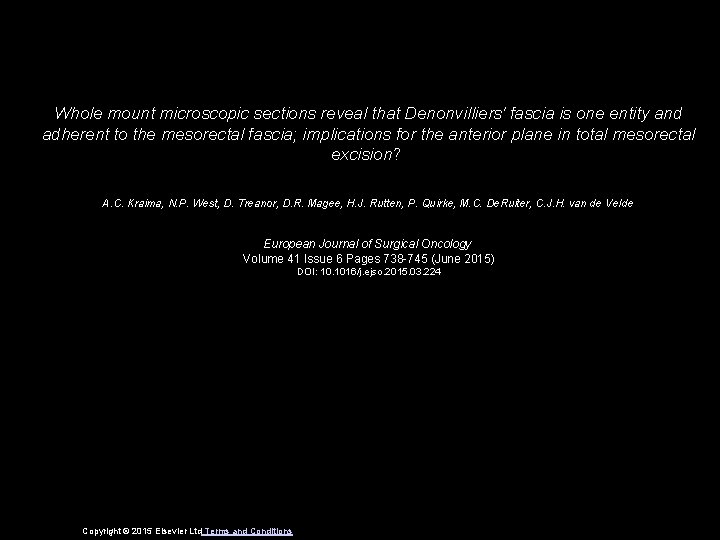 Whole mount microscopic sections reveal that Denonvilliers' fascia is one entity and adherent to
