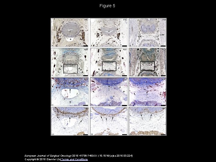 Figure 5 European Journal of Surgical Oncology 2015 41738 -745 DOI: (10. 1016/j. ejso.