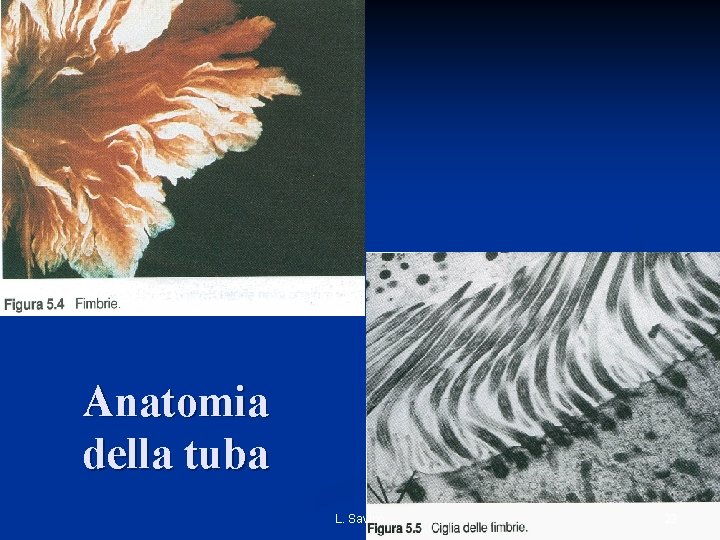 Anatomia della tuba L. Savino 23 