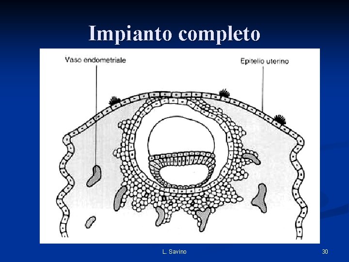 Impianto completo L. Savino 30 Impianto completo L. Savino 30