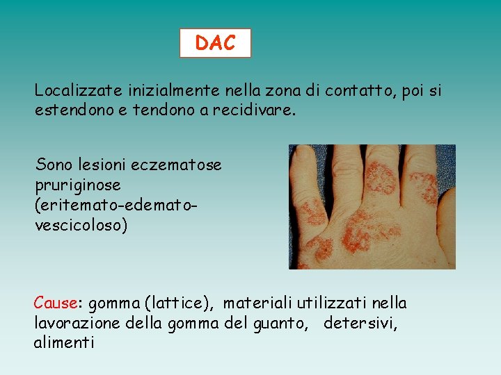 DAC Localizzate inizialmente nella zona di contatto, poi si estendono e tendono a recidivare.