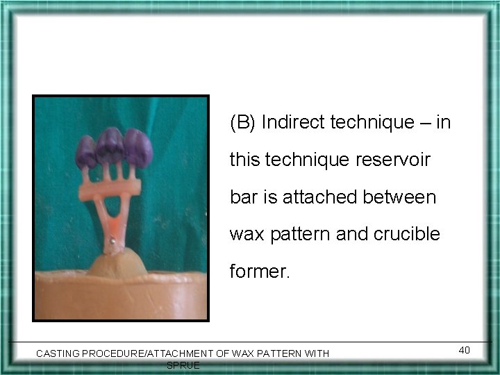 (B) Indirect technique – in this technique reservoir bar is attached between wax pattern