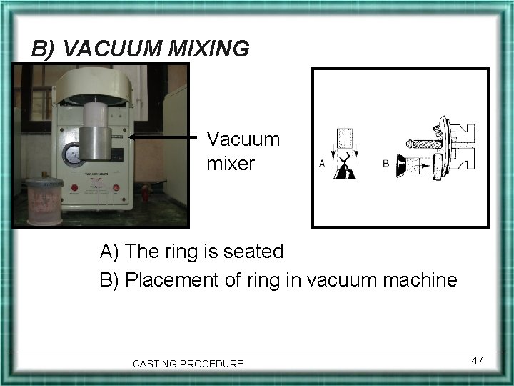 B) VACUUM MIXING Vacuum mixer A) The ring is seated B) Placement of ring