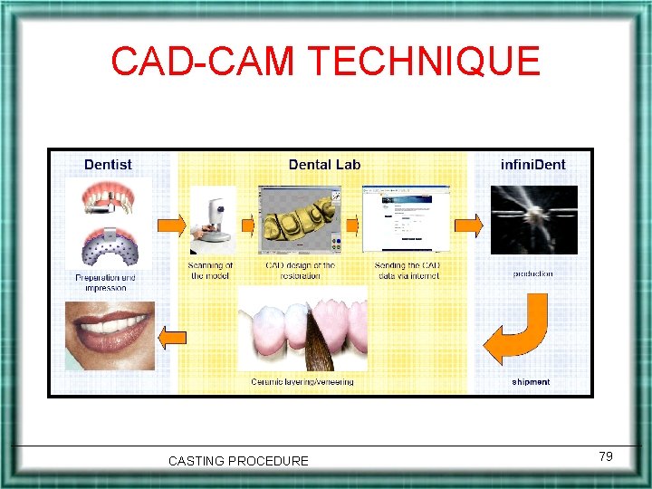 CAD-CAM TECHNIQUE CASTING PROCEDURE 79 