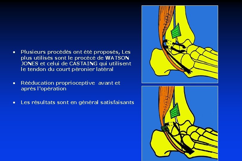 • Plusieurs procédés ont été proposés, Les plus utilisés sont le procécé de • Plusieurs procédés ont été proposés, Les plus utilisés sont le procécé de