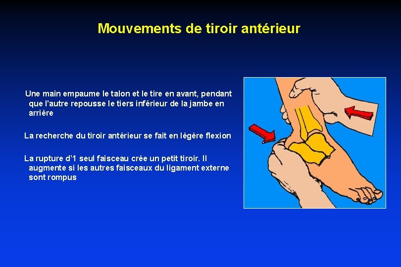 Mouvements de tiroir antérieur Une main empaume le talon et le tire en avant, Mouvements de tiroir antérieur Une main empaume le talon et le tire en avant,