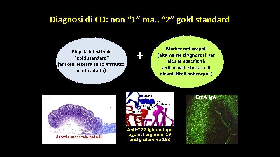 Diagnosi di CD: non “ 1” ma. . “ 2” gold standard Biopsia intestinale