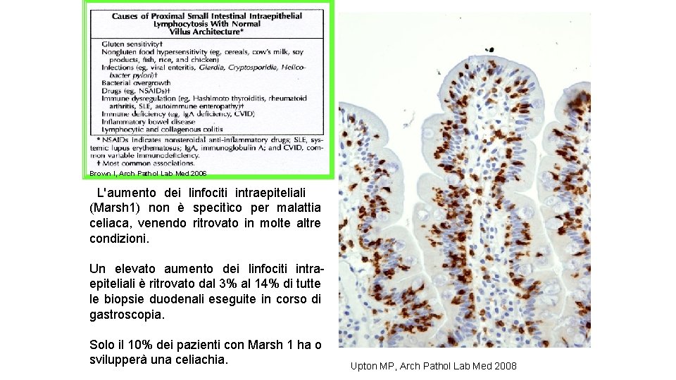 Brown I, Arch Pathol Lab Med 2006 L'aumento dei linfociti intraepiteliali (Marsh 1) non