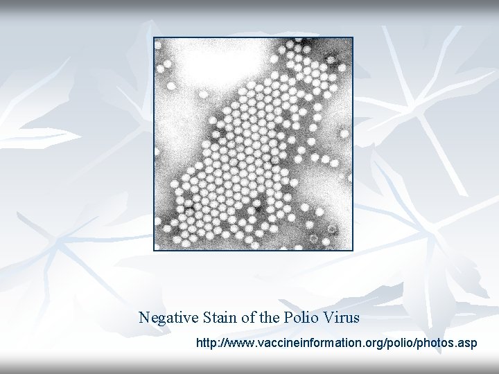 Negative Stain of the Polio Virus http: //www. vaccineinformation. org/polio/photos. asp 