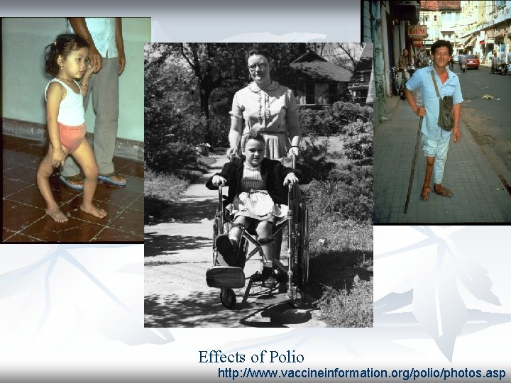 Effects of Polio http: //www. vaccineinformation. org/polio/photos. asp 