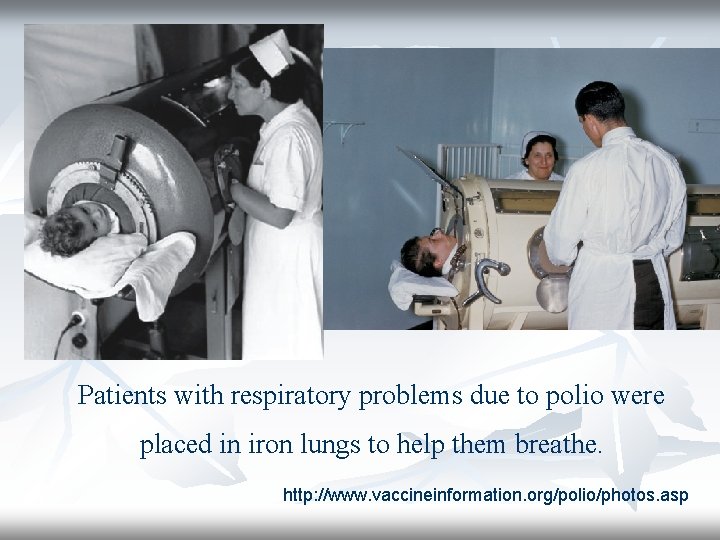 Patients with respiratory problems due to polio were placed in iron lungs to help