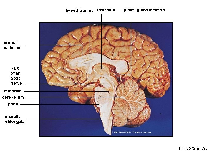 hypothalamus pineal gland location corpus callosum part of an optic nerve midbrain cerebellum pons