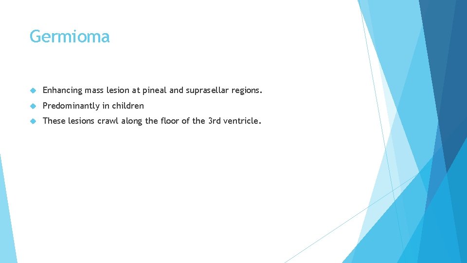 Germioma Enhancing mass lesion at pineal and suprasellar regions. Predominantly in children These lesions