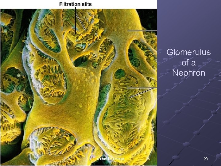 Glomerulus of a Nephron mehdi jalali majd 23 