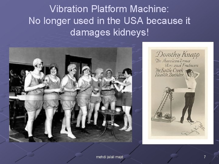 Vibration Platform Machine: No longer used in the USA because it damages kidneys! mehdi