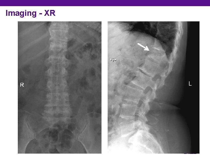 Imaging - XR Division of ________ Department of Orthopedic Surgery 