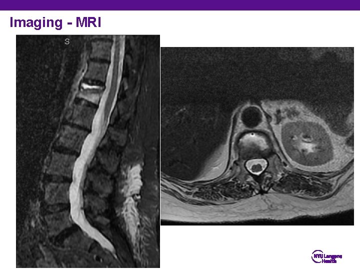 Imaging - MRI 4 Division of ________ Department of Orthopedic Surgery 