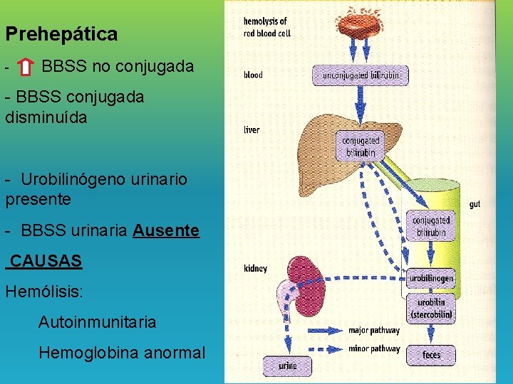 Prehepática - BBSS no conjugada - BBSS conjugada disminuída - Urobilinógeno urinario presente -