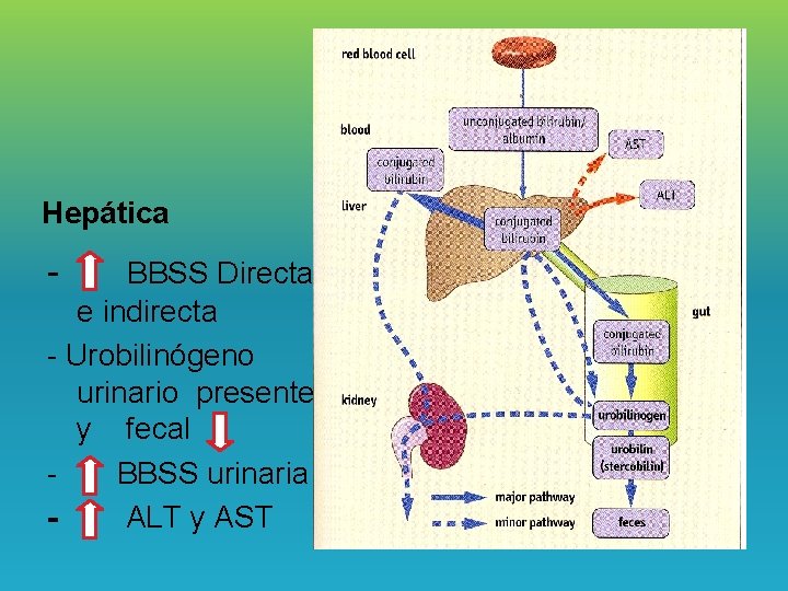 Hepática - BBSS Directa e indirecta - Urobilinógeno urinario presente y fecal BBSS urinaria