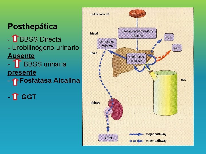 Posthepática BBSS Directa - Urobilinógeno urinario Ausente BBSS urinaria presente - Fosfatasa Alcalina -