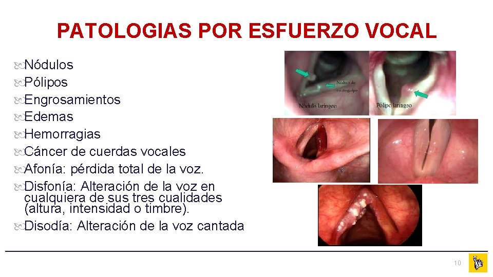 PATOLOGIAS POR ESFUERZO VOCAL Nódulos Pólipos Engrosamientos Edemas Hemorragias Cáncer de cuerdas vocales Afonía:
