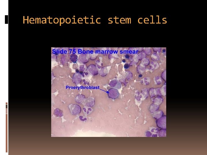 Hematopoietic stem cells 