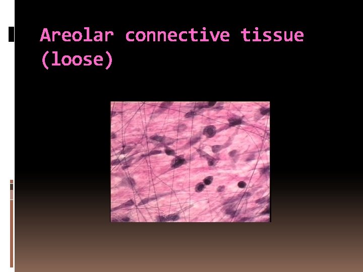 Areolar connective tissue (loose) 