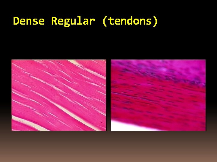 Dense Regular (tendons) 