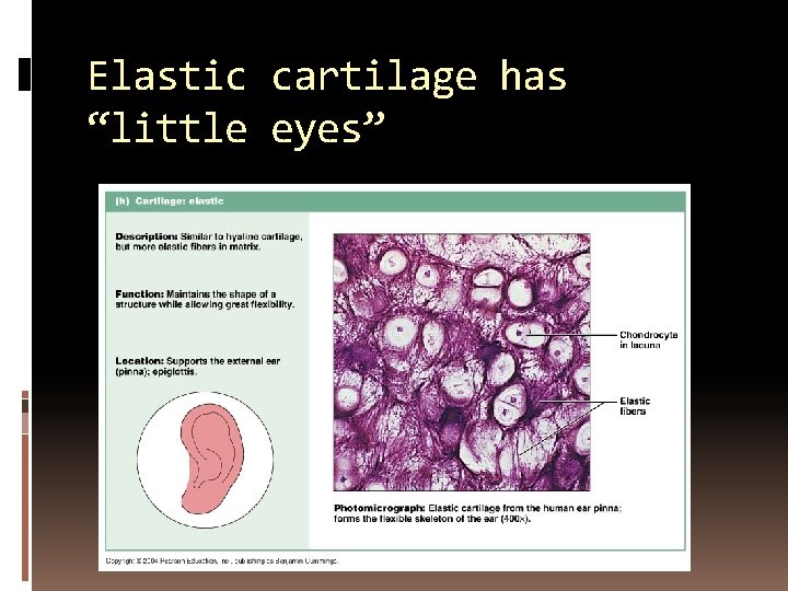 Elastic cartilage has “little eyes” 