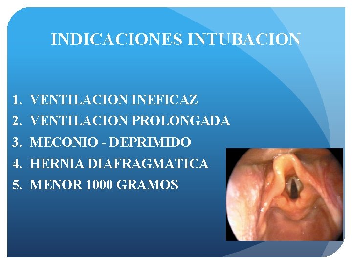 INDICACIONES INTUBACION 1. VENTILACION INEFICAZ 2. VENTILACION PROLONGADA 3. MECONIO - DEPRIMIDO 4. HERNIA