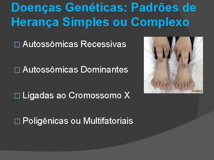 Doenças Genéticas: Padrões de Herança Simples ou Complexo � Autossômicas Recessivas � Autossômicas Dominantes