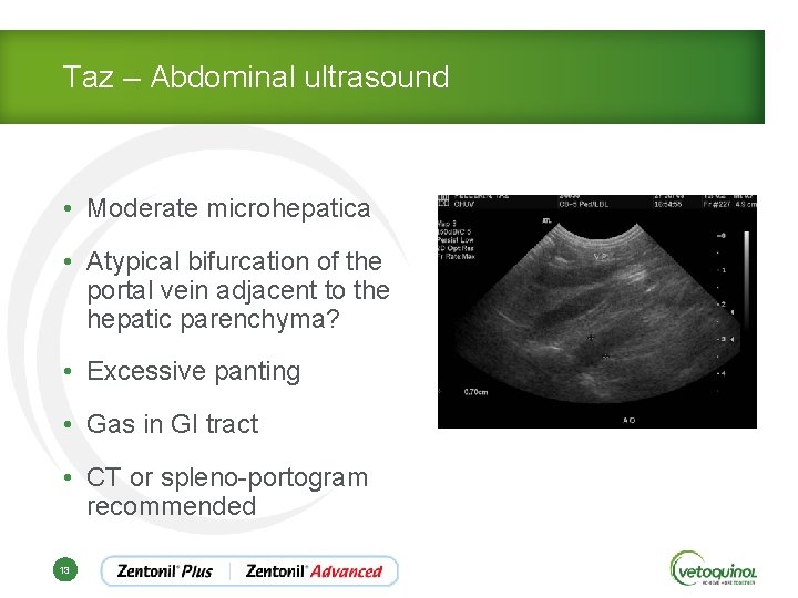 Taz – Abdominal ultrasound • Moderate microhepatica • Atypical bifurcation of the portal vein